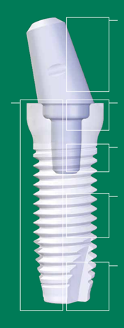 A diagram of zirconia crown implant base at Periodontal Surgical Arts in Austin, TX